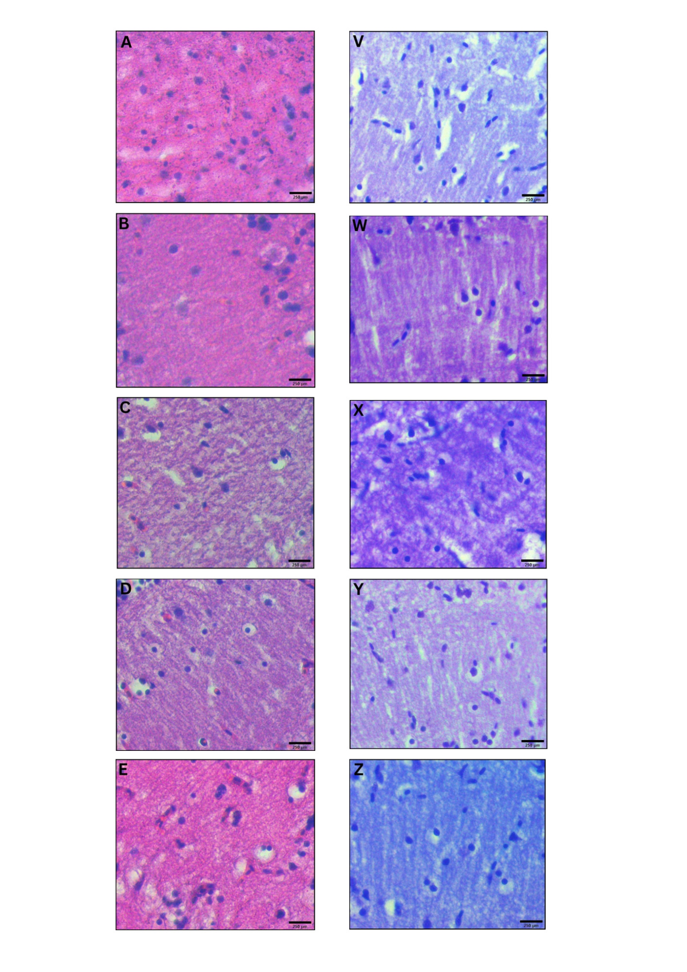Microscopic appearance of ventral diencephalon stained with H & E (left) and cresyl violet (right) in different treated groups. A and V: normal group; B and W: negative (MPTP-treated) group; C and X: LD (25 mg/L) group; D and Y: MD (50 mg/L) group and E and Z: HD (100 mg/L) group