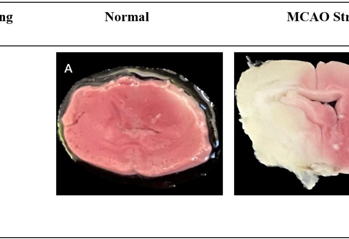 FIGURE 1: Representative images of 2,3,5-triphenyltetrazolium chloride (TTC) stained brain slices; (A) The normal group's rat brain had no differences in colouring; (B) The infarcted (white) and non-infarcted (red) areas of the rat brain were clearly separated by the MCAO stroke model