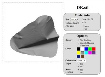 Figure 1: Optical scan (EinScan-Pro Scan, 3D Systems) of right orbital implant in stereolithographic (STL) data